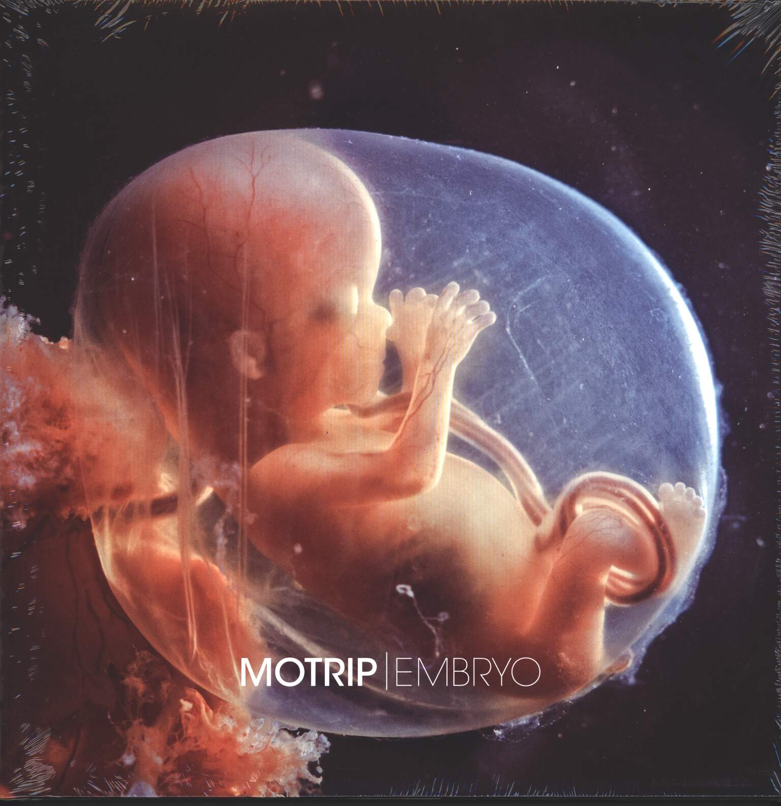 Motrip: Embryo, 2×LP (Vinyl)