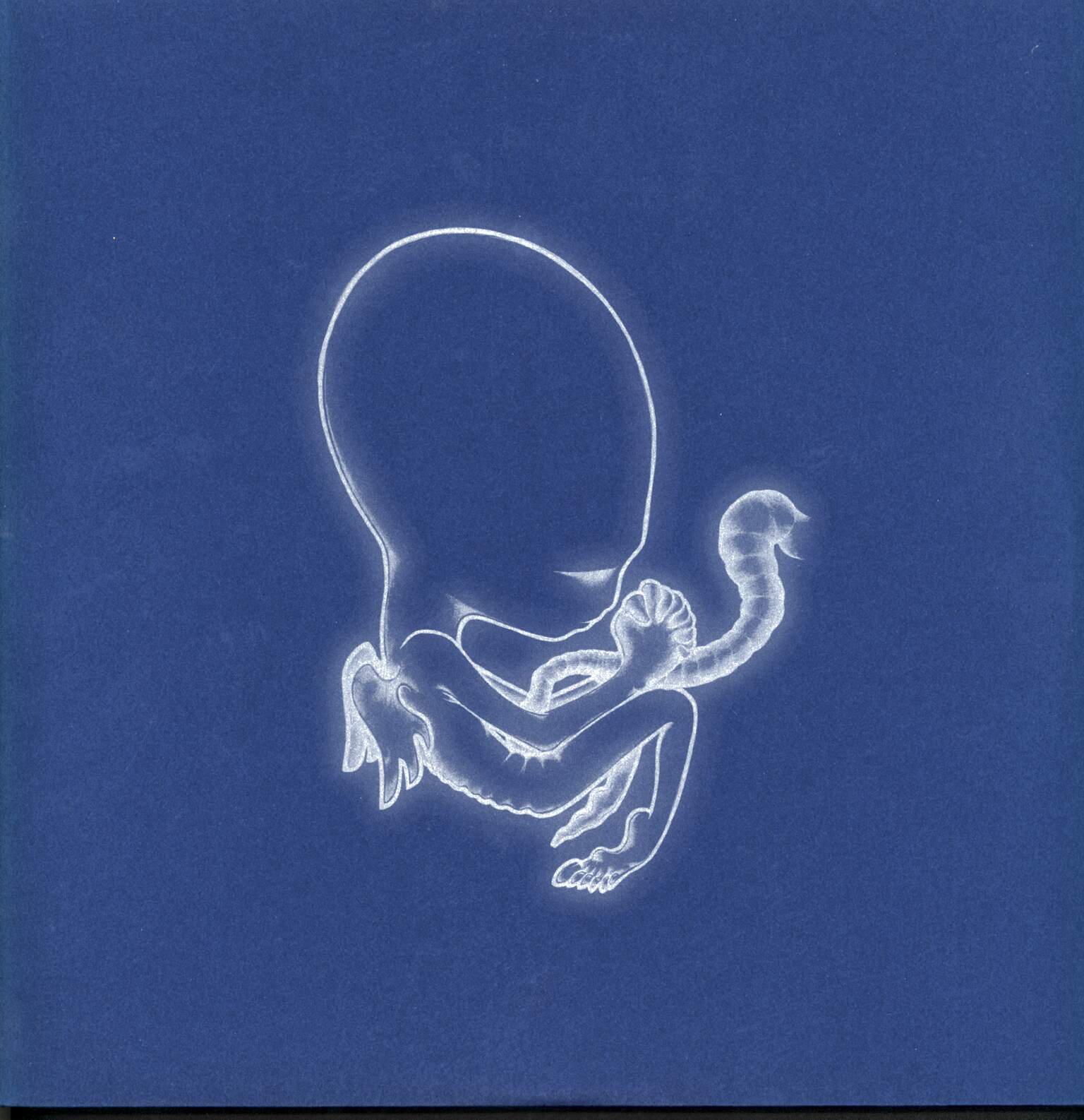 Sigur Ros: Ágætis Byrjun, 2×LP (Vinyl), 1×CD