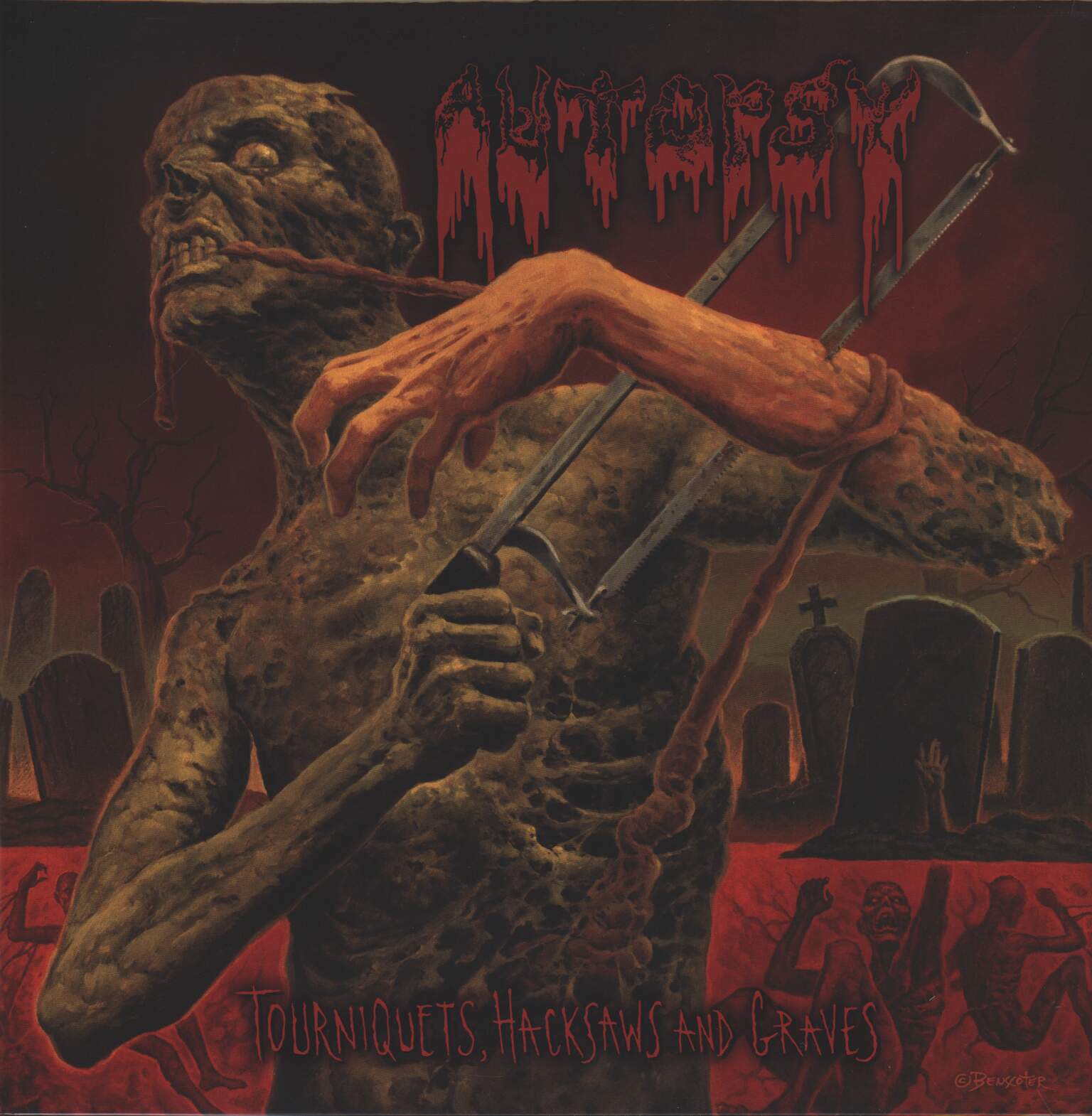 Autopsy: Tourniquets, Hacksaws And Graves