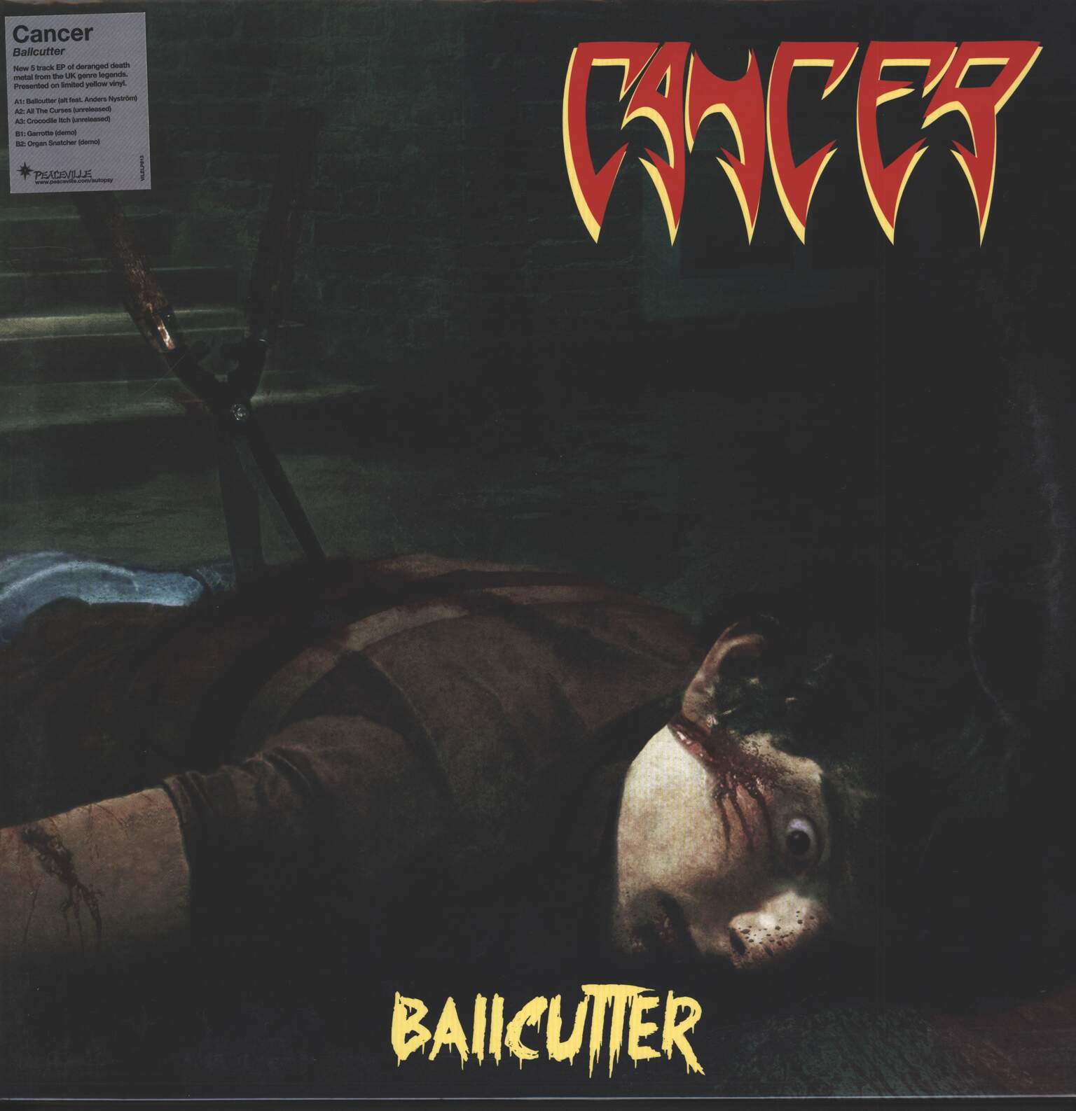 Cancer: Ballcutter