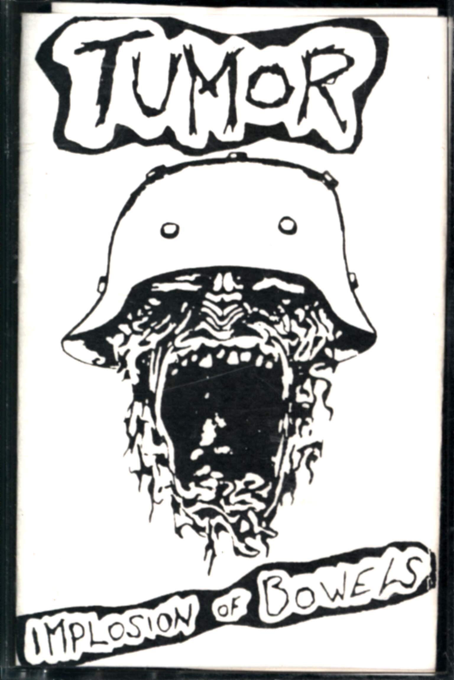 Tumor: Implosion Of Bowels